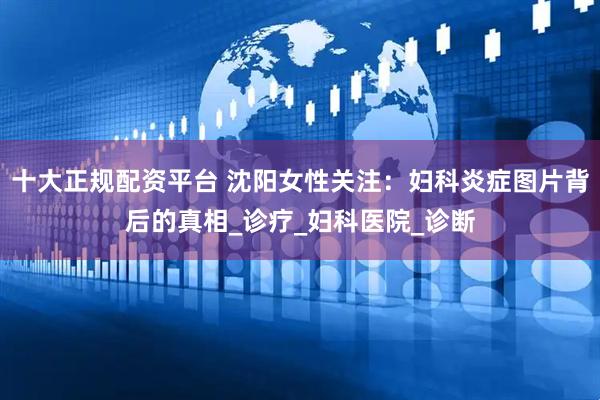 十大正规配资平台 沈阳女性关注：妇科炎症图片背后的真相_诊疗_妇科医院_诊断